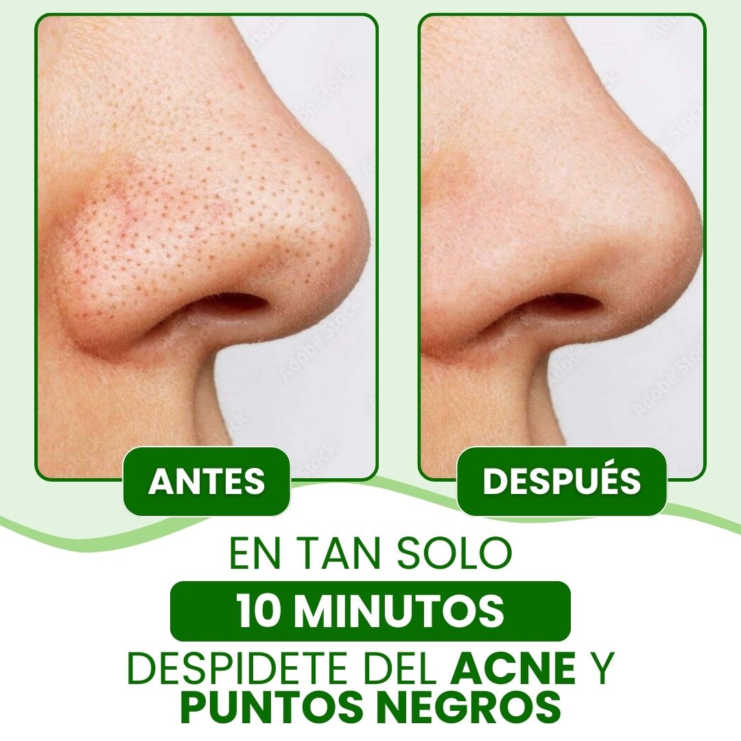 Mascarilla Lanbena®